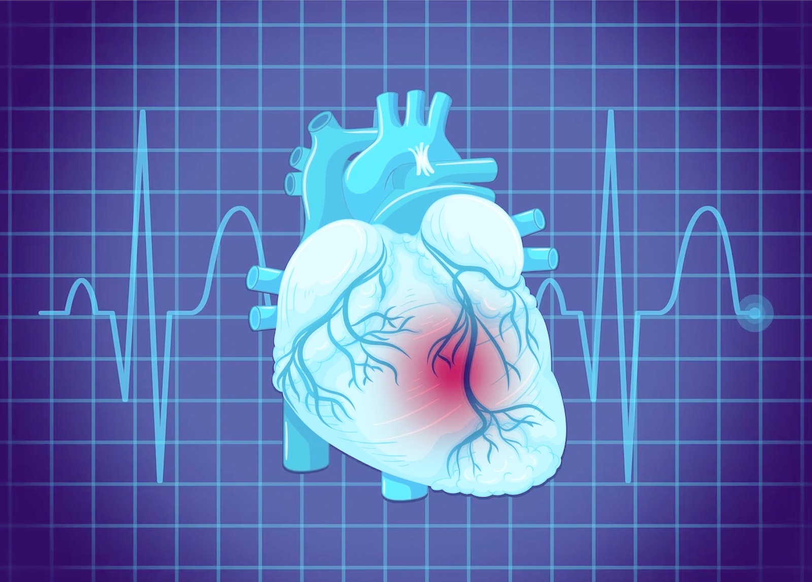 Bridging the Genomic Knowledge Gap on Peripartum Cardiomyopathy