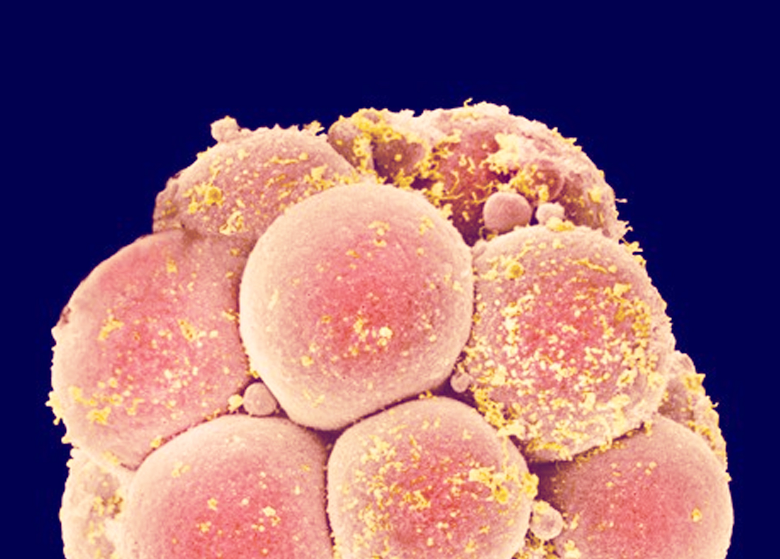 ‘CRISPR babies’ are still too risky, says influential panel